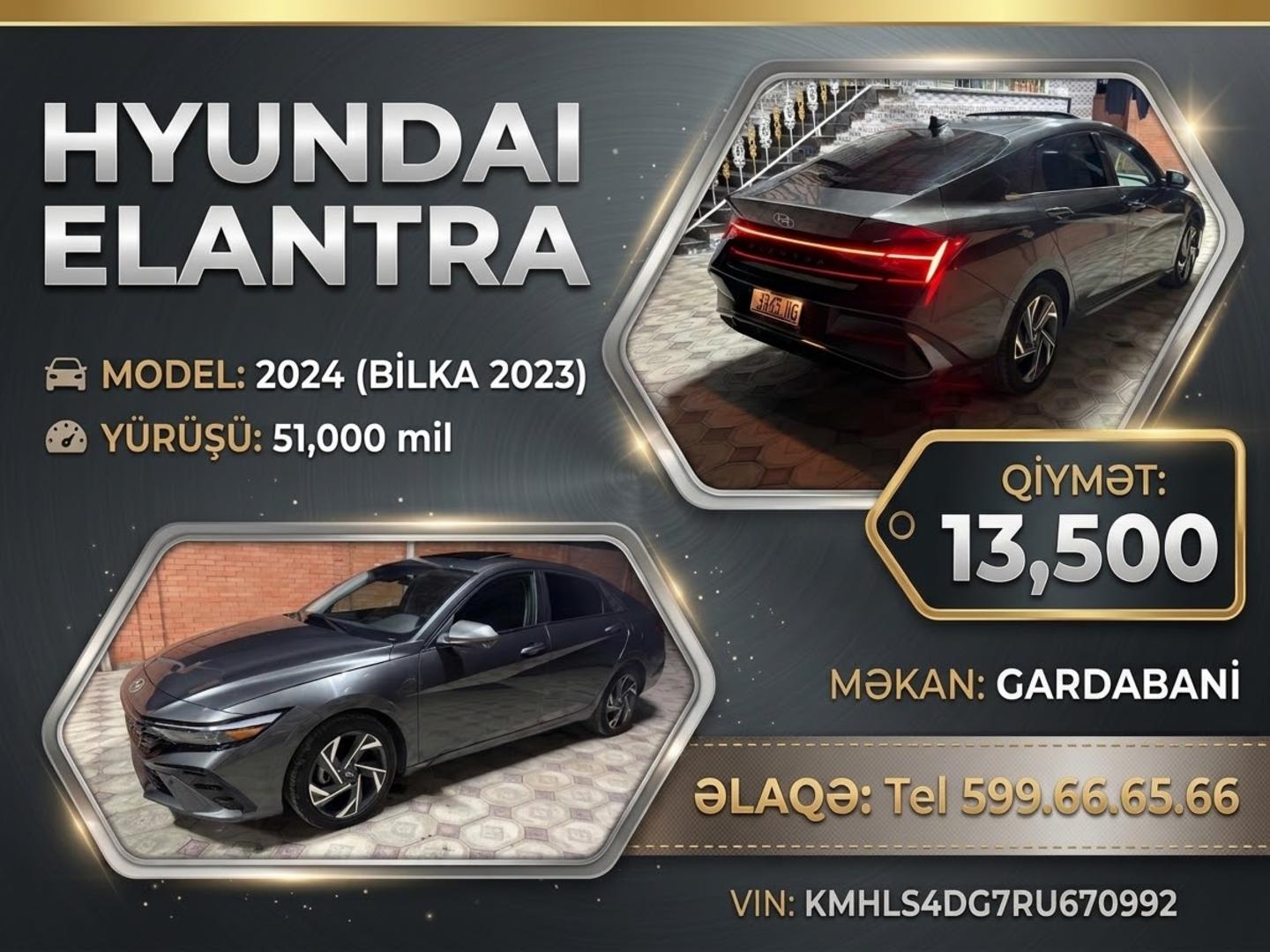 Hyundai Elantra 2024 — photo 2